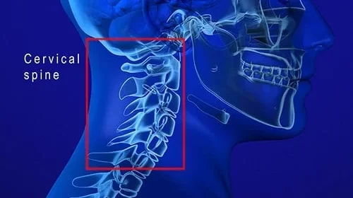 C3-C4-C5-Spinal-Cord-Injury-min
