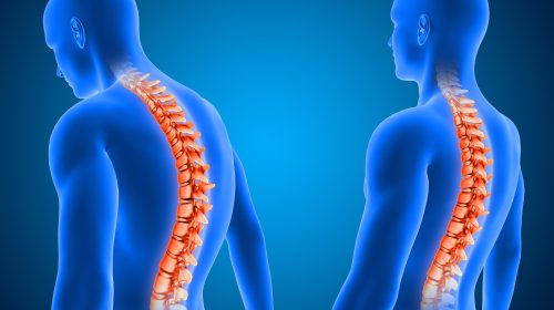 Role-Of-Physiotherapy-In-Spinal-Cord-Injury_Medical-Rehabilition-center