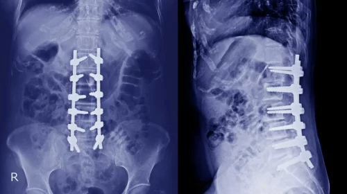 Stages-of-DDD