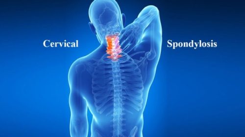 varma-cervical-1024x647-1
