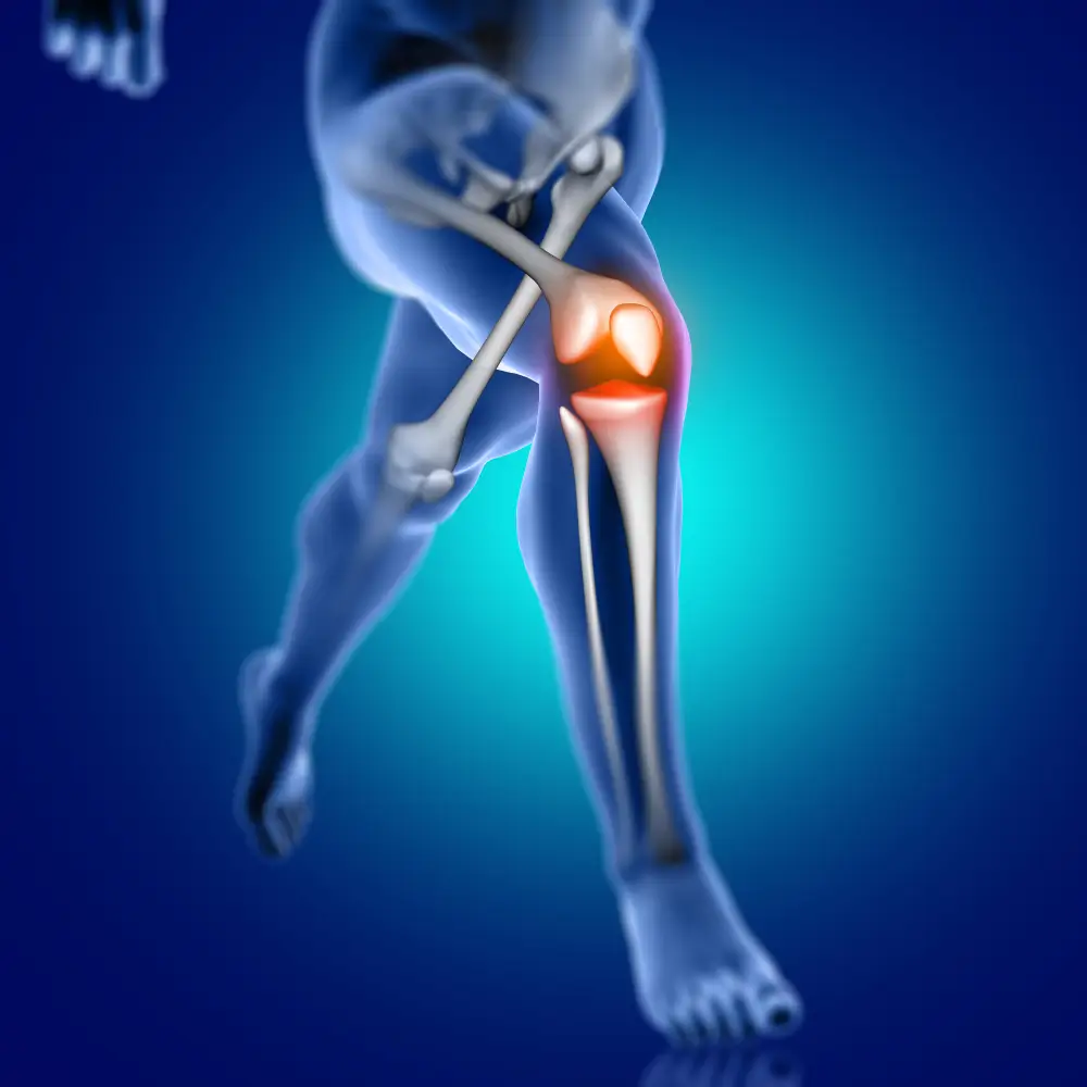 ACL-Injuries