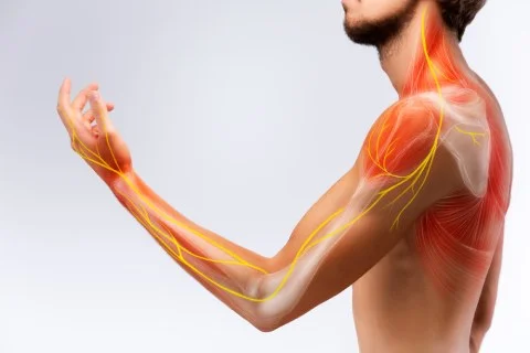 CERVICAL-RADICULOPATHY