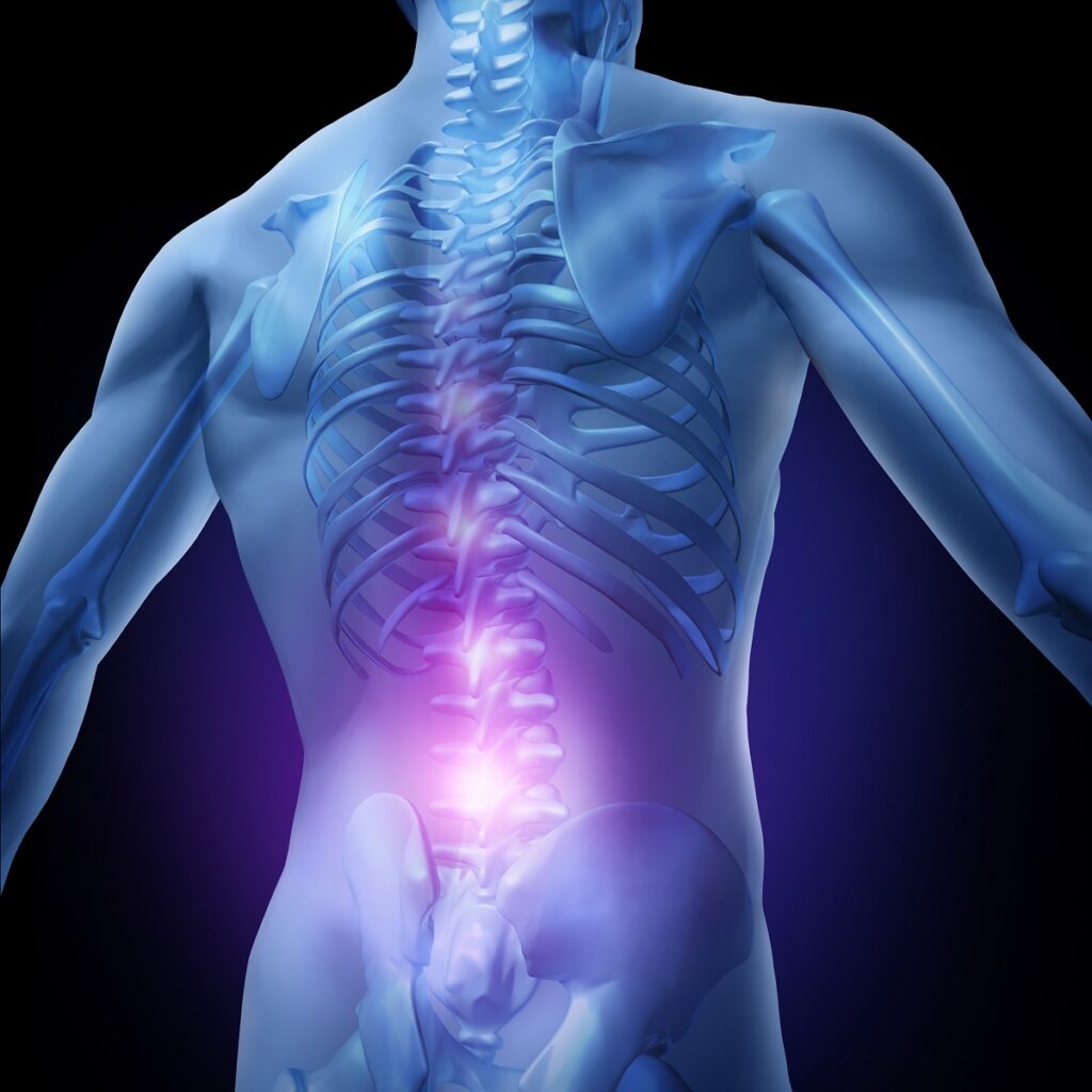 Cauda-Equina-Syndrome-Treatment-1024x1024