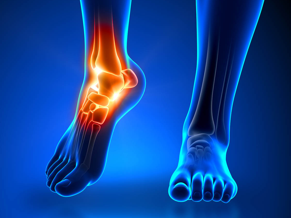 Condition-Ankle-uai-1200x900