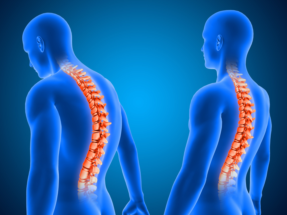 Role-Of-Physiotherapy-In-Spinal-Cord-Injury_Medical-Rehabilition-center