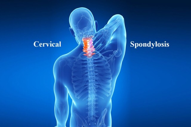 varma-cervical-1024x647-1